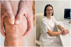 Žiemą skauda sąnarius? Gydytoja patarė išbandyti natūralias priemones