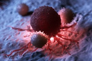 Stebuklas: skelbia, kad naujas vaistas žudo vėžines ląsteles