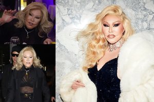 Mirė milijonus plastinėms operacijoms išleidusi moteris-katė Jocelyn Wildenstein