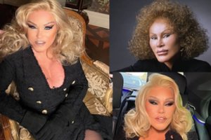 Aiškėja daugiau moters-katės J. Wildenstein mirties detalių: prabilo mylimasis