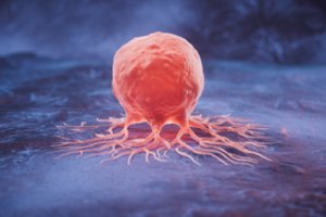 Norite nesirgti vėžiu? Šiukštu venkite šių vitaminų trūkumo