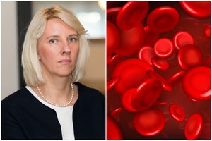 Gydytoja: kraujotakos sutrikimą išduoda stiklinės metodas – gali išgelbėti gyvybę