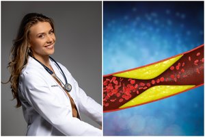 Šeimos gydytoja: įgyvendinus šiuos punktus, galima sėkmingai sumažinti cholesterolio kiekį