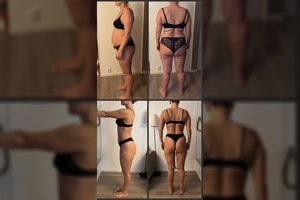 Gelbėjimosi rato ir raukšlių nugaroje Silvija atsikratė pačiu lengviausiu būdu: „Buvo paprasta ir lengva“ 