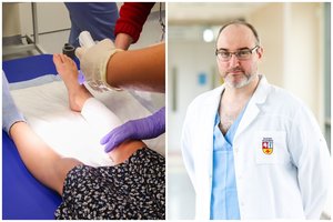 Vaikų odos nudegimai: ką svarbu žinoti kiekvienam tėvui?