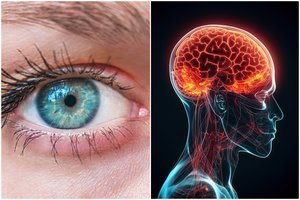 Kraujagyslių „piršto atspaudas“: atrado naują būdą nuspėti, ar žmogus patirs insultą