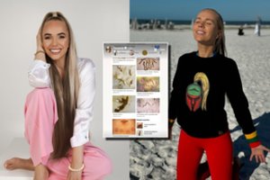 Ievos Voveris organizme apsigyveno parazitai: nusprendė imtis kardinalių priemonių