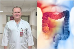 Profesorius išvardijo, kokie žmonės dažniau serga storosios žarnos vėžiu: „Neabejotinai daro neigiamą įtaką“