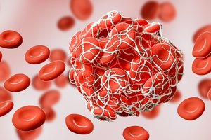 Dėl populiaraus maisto papildo – mediko įspėjimas: gali išprovokuoti kraujo krešulius