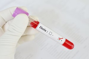 Sveikatos apsaugos ministerija: Ugandoje per Ebolos protrūkį mirė žmogus