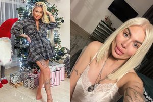 Aliona Lapinskienė prabilo apie atliktą plastinę operaciją: „Pakelta, užriesta, kaip pas Barbę“