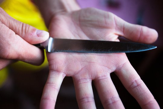 Kupiškio rajone ir Šiauliuose girtos moterys peiliu sužalojo savo sugėrovus
