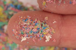 Tyrimas: žmogaus smegenyse ir kepenyse kaupiasi vis daugiau plastiko dalelių