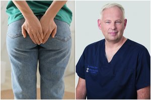 Kokie žmonės suserga hemorojumi? Gydytojas paneigė giliai įsišaknijusį įsitikinimą