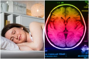 Gydytoja įspėjo prieš miegą nedaryti vienos klaidos: tai gali prišaukti insultą