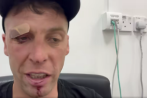 Kelis kartus galvą susitrenkęs A. Gelažninkas atsidūrė ligoninėje