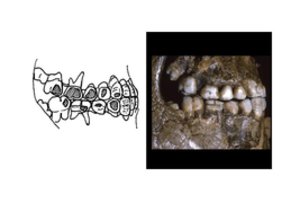 Mokslininkas: šie ženklai išduoda, kad ledynmečio laikais auskarai į skruostus buvo veriami jau dešimtmečiams