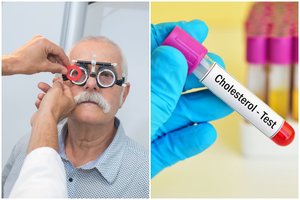 Netikėta tyrimo išvada: „blogasis“ cholesterolis apsaugo nuo klastingos ligos