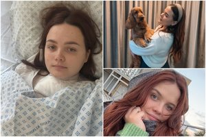 Kaunietė baisiausiame sapne nesapnavo, kaip pasikeis jos gyvenimas: tirpstančios rankos buvo tik pradžia