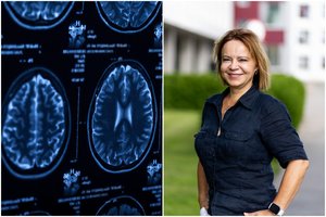 Epilepsija: neurologė išvardijo dažniausias ligos priežastis