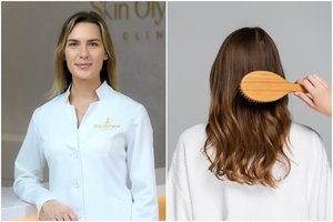 Gydytoja apie plaukus: tai vienas akivaizdžiausių amžėjimo požymių