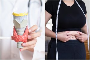 Gydytoja įspėjo: augantis svoris ir šalčio pojūtis – ženklai, kad sutriko svarbus organas