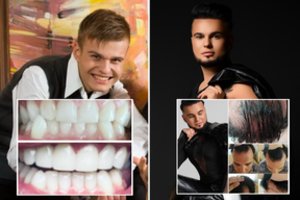 V. Partikas parodė, kaip atrodė anksčiau: atskleidė visas plastines operacijas ir kirto komentatoriams: „Pavyduoliai“