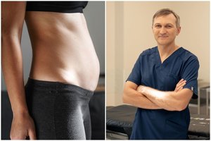 Viskas apie operacijas, sugrąžinančias formas po gimdymo: kada verčiau to nedaryti