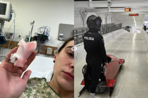 Šiurpi nelaimė: treniruotės metu lenkė neteko dalies piršto