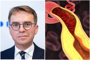 Profesorius patarė, kaip pagerinti kraujotaką: šis produktas – pati natūraliausia priemonė cholesteroliui mažinti