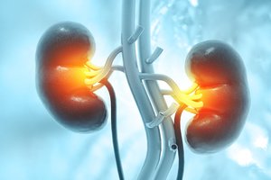 Naujas proveržis gydant retą inkstų ligą: vaistai vietoj organų transplantacijos