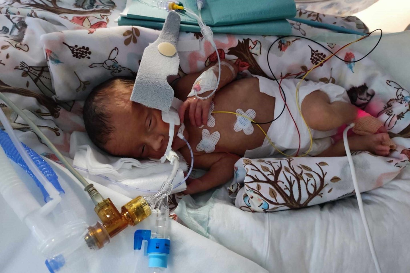 Jonas pasaulį išvydo anksčiau laiko ir gimė sverdamas vos 1390 g.<br> Asmeninio archyvo nuotr.