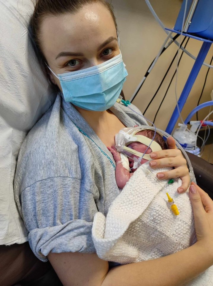 Nuo pirmųjų savo gyvenimo savaičių Jonas iš visų jėgų kabinosi į gyvenimą.<br> Asmeninio archyvo nuotr.