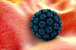 Vėžys, kuriuo dažnai suserga jaunos moterys: apie pusė jų miršta