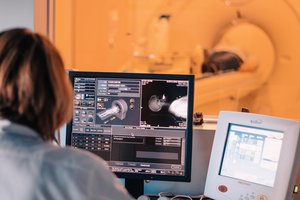 Gydytoja: retą ligą gali išduoti specifiniai veido bruožai