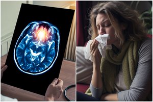 Atrodo peršalimas, o staiga pažeidžia smegenis: Lietuvoje skaičiuoja mirtis nuo pavojingos infekcijos