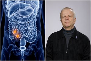 Vėžį nugalėjęs pensininkas Arvydas nestabdo: natūraliai sutvarkė cholesterolį ir gliukozės kiekį – net gydytojai stebisi