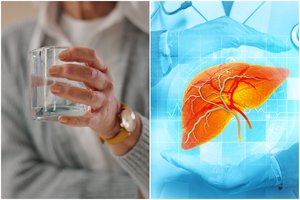 Medikai paneigė mitą apie vitaminą A ir įspėjo dėl šalutinių poveikių: gali pažeisti kaulus ir kepenis