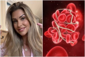 „Instagramo“ žvaigždę parklupdė kraujo krešulys: prašo neignoruoti šių simptomų