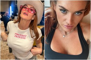 Būdama 16-likos mergina sužinojo, kad turi dvi vaginas: iš to susikrovė milijonus ir didžiuojasi