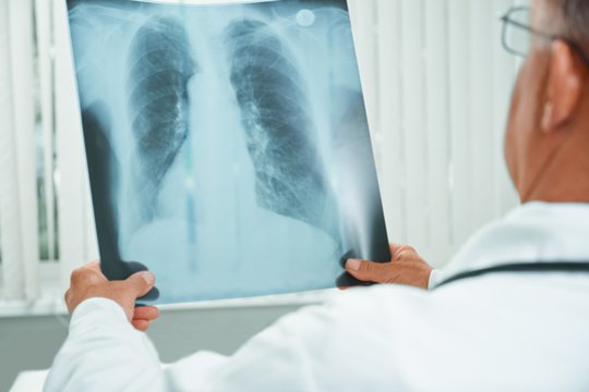 Mitais ir baime apipinta tuberkuliozė – kodėl nereikia gėdytis šios ligos bei kaip nuo jos apsisaugoti?