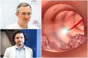 Gydytojai įspėja lietuvius: sparčiai daugėja vėžio atvejų – vienas simptomas daug pasako