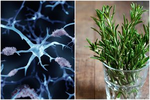 Mano atradę priešnuodį nuo Alzheimerio ligos – smegenyse nustoja kauptis žalingi baltymai