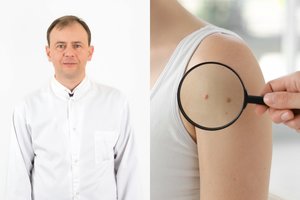 Daugybę odos vėžio atvejų matęs chirurgas prisiminė stebuklingai išgyvenusį pacientą: situacija atrodė beviltiška