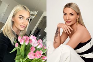 Monika Kvietkutė prabilo apie kankinančias odos problemas: „Pažvelgusi į veidrodį savęs girti nepuolu“