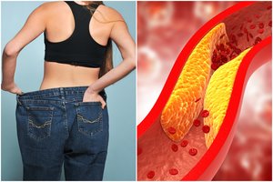 Atrado ypač veiksmingą metodą svoriui mesti: tirpsta riebalai ir susitvarko cholesterolis