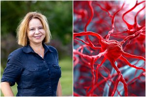 Profesorė pastebi, kad keičiasi žmonių požiūris į epilepsiją: „Ši liga gali ištikti bet kurį“