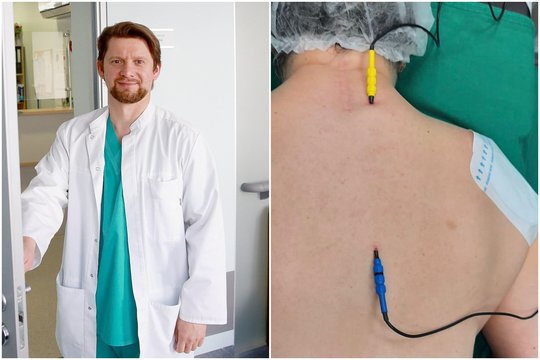 Lietuvoje – naujas gydymo metodas: skausmus malšina elektriniai impulsai