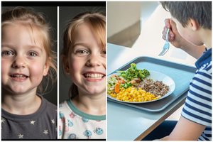 Ką jūsų vaiko veidas ir elgesys išduoda apie jo mitybą?