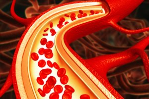 Išmokite kaip maldą: 5 kardiologės taisyklės, kaip pagerinti kraujotaką
